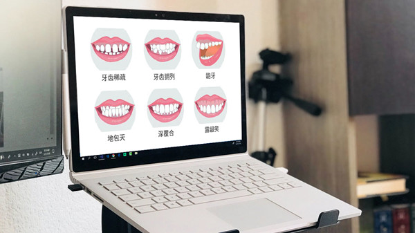 牙齒矯正的問(wèn)題 牙齒矯正的問(wèn)題