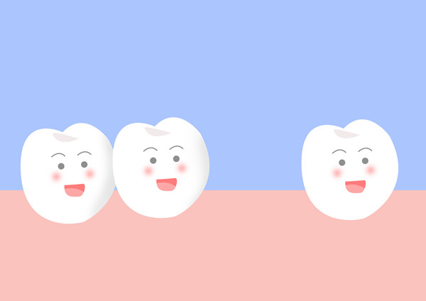 牙齒缺失鑲牙 牙齒缺失鑲牙