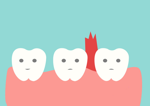 刷牙出血 刷牙出血